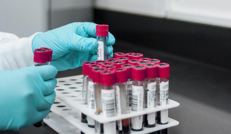 Test seroneutralizacji wirusa EAV – ważne